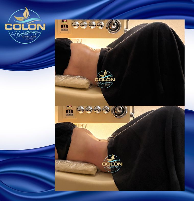 Client before and after — result 1