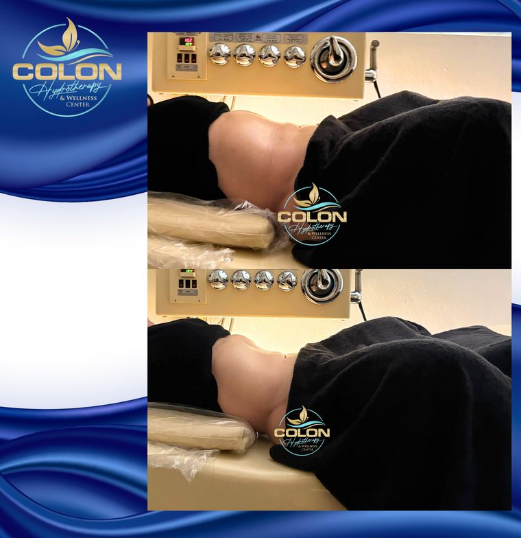 Client before and after — result 3