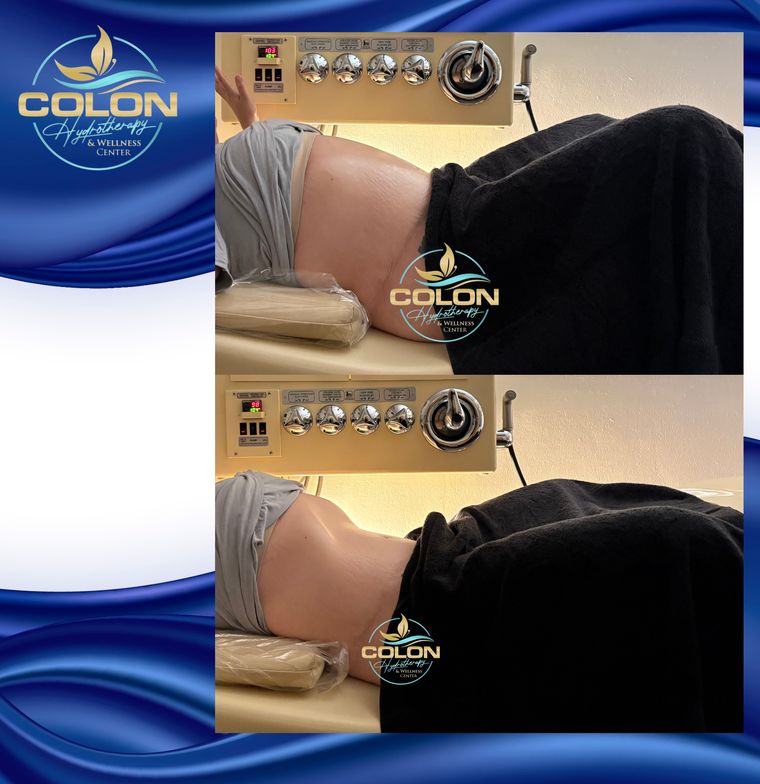 Client before and after — result 4