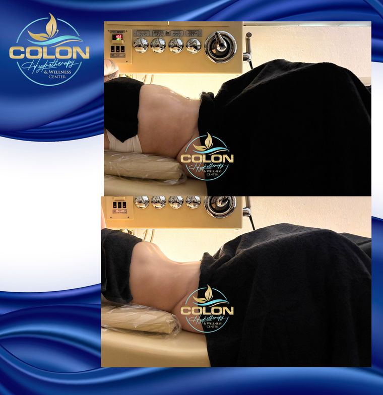 Client before and after — result 7