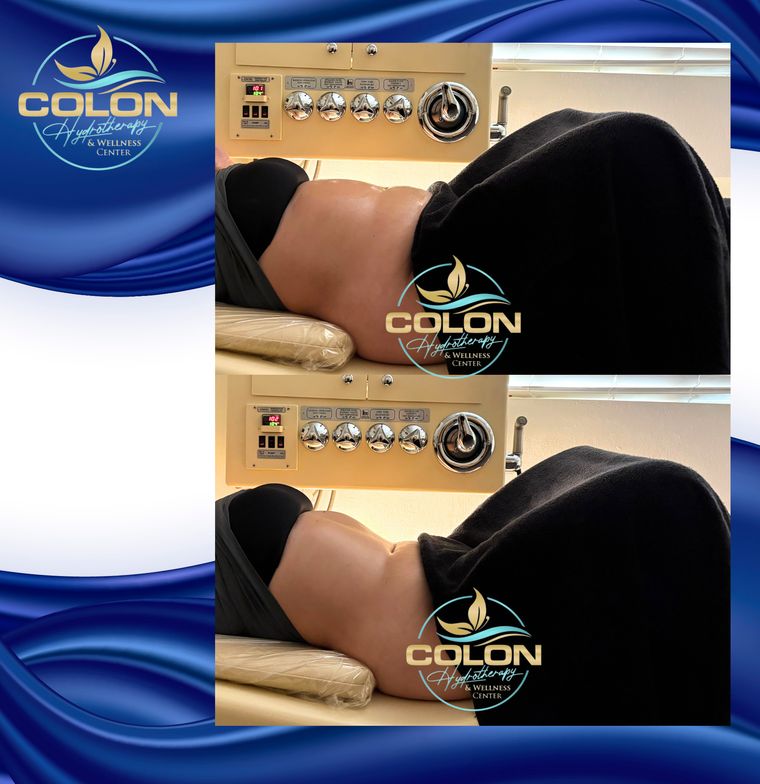 Client before and after — result 12