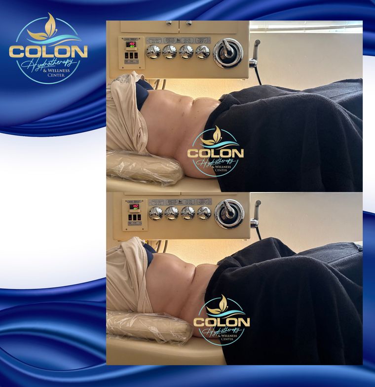 Client before and after — result 17