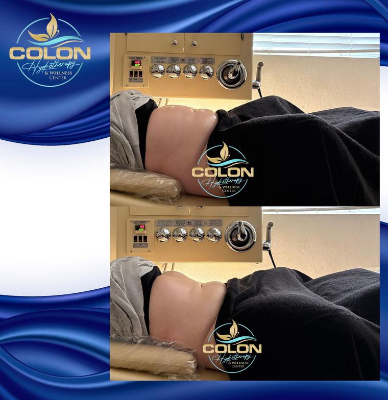 Client before and after — result 18