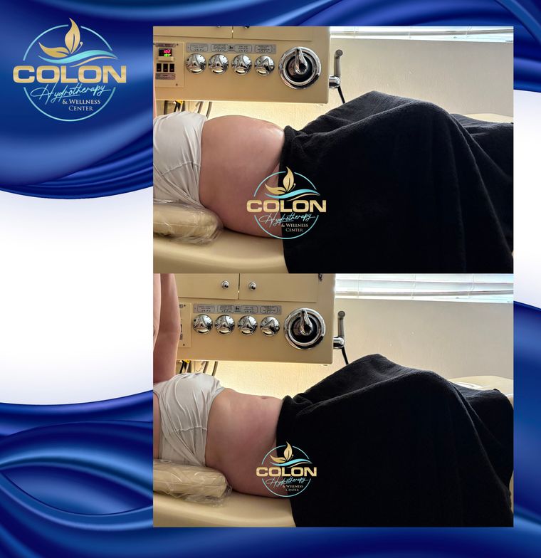 Client before and after — result 20
