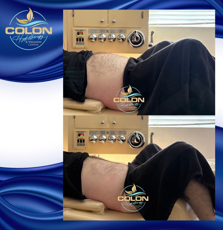 Client before and after — result 22