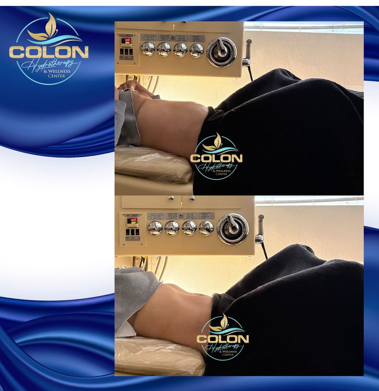 Client before and after — result 23