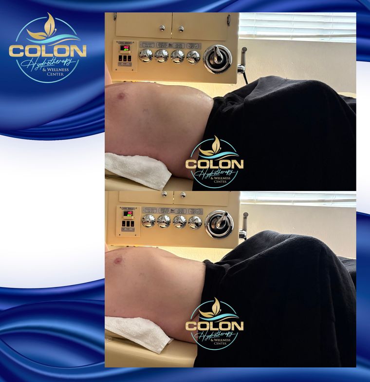 Client before and after — result 27