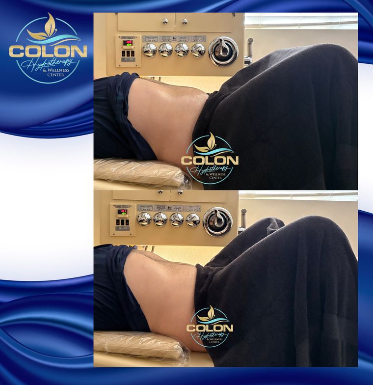Client before and after — result 32
