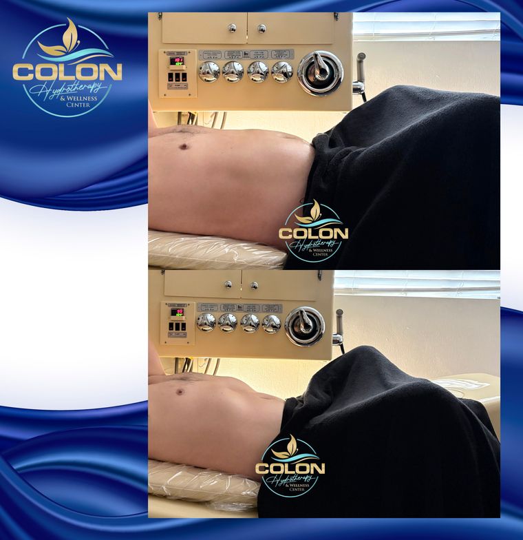Client before and after — result 33