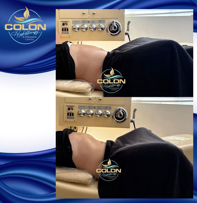 Client before and after — result 34