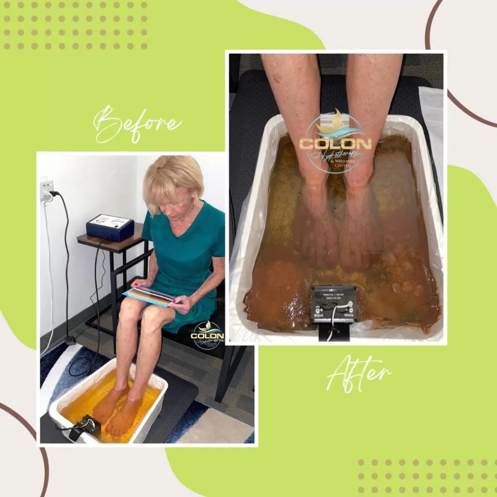 Ionic foot detox before and after — clear water before, dark amber water after the session