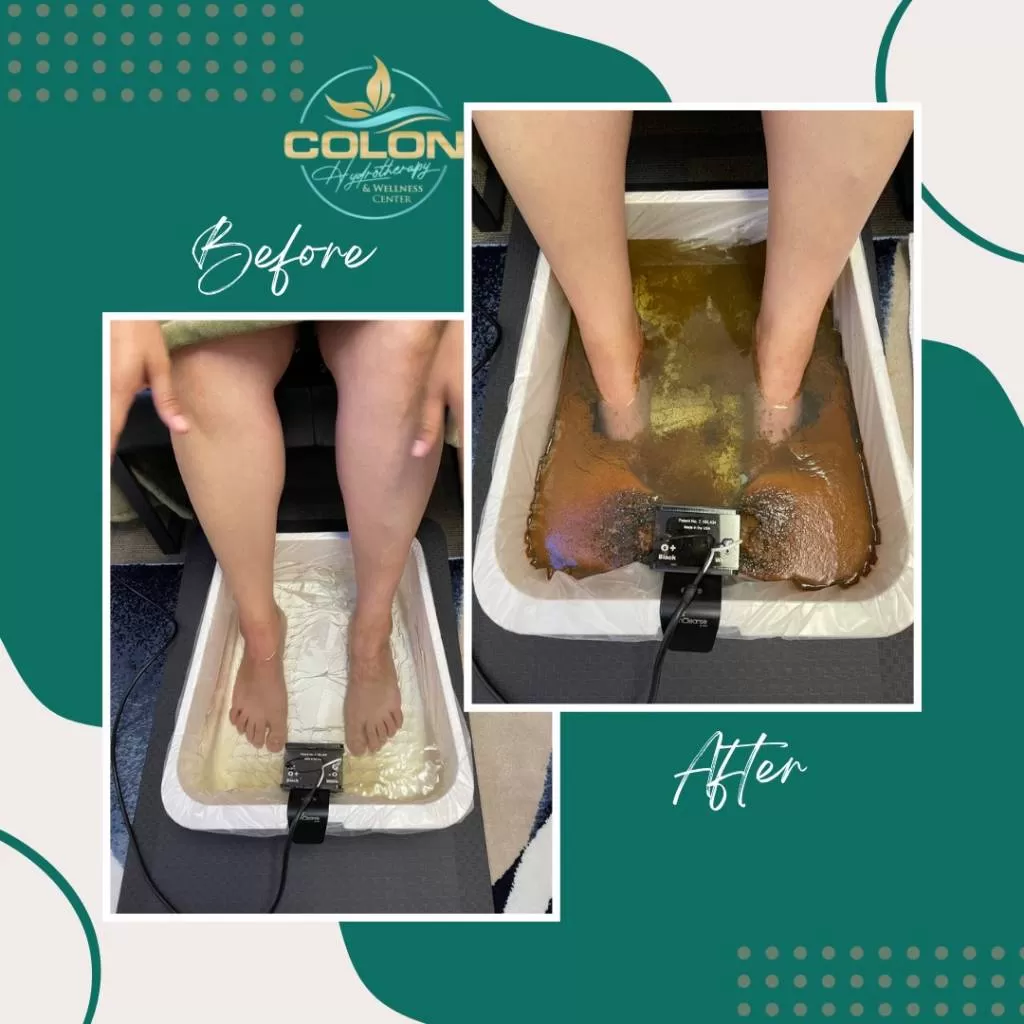 Ionic foot detox before and after — client result